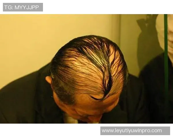 霍华德调侃布朗发际线问题推荐Tony助力解决秃顶烦恼